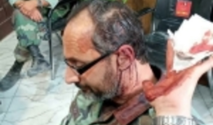 عامل ضرب و شتم مأموران یگان حفاظت منابع طبیعی استان تهران دستگیر شد