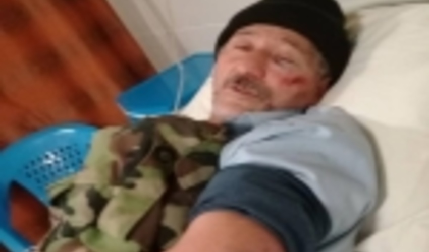 ضرب و شتم جنگلبانان از سوی قاچاقچیان چوب در تالش