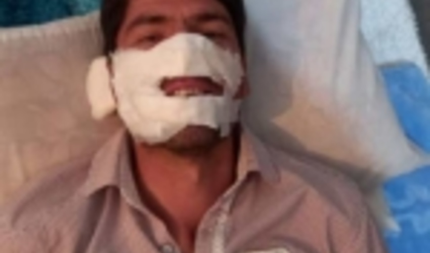 دستور ویژه رئیس سازمان جنگل ها برای اعزام  کوهنورد کهگیلویه و بویراحمدی به بیمارستانی در استان فارس