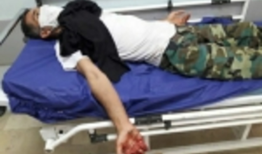 مامور منابع طبیعی کردکوی توسط دامدار متخلف مورد ضرب و شتم قرار گرفت