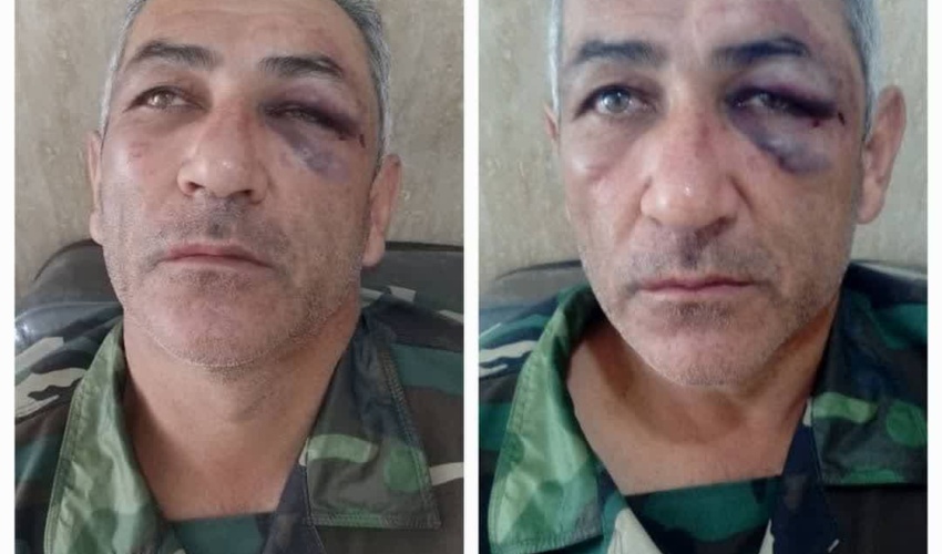 گیلان / بار دیگر ضرب و شتم جنگلبان